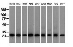 Invitrogen EMG1 Monoclonal Antibody (OTI1B8) 100 &mu;L; Unconjugated:Antibodies,