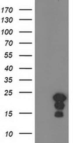 Invitrogen HSPB8 Monoclonal Antibody (OTI1E3) 100 &mu;L | Buy Online | Invitrogen&trade; | Fisher Scientific