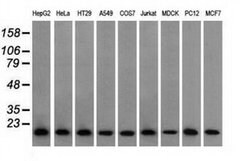 Invitrogen Profilin 1 Monoclonal Antibody (OTI1D5) 100 &mu;L; Unconjugated:Antibodies,