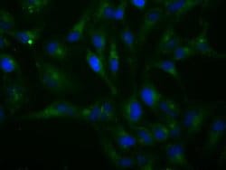 Invitrogen H6PD Monoclonal Antibody (OTI1H6) 100 &mu;L; Unconjugated:Antibodies,