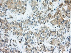 Invitrogen H6PD Monoclonal Antibody (OTI1H6) 100 &mu;L; Unconjugated:Antibodies,