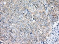 Invitrogen H6PD Monoclonal Antibody (OTI1H6) 100 &mu;L; Unconjugated:Antibodies,