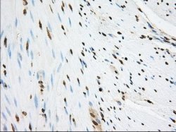 Invitrogen SNX9 Monoclonal Antibody (OTI1B5) 100 &mu;L; Unconjugated:Antibodies,