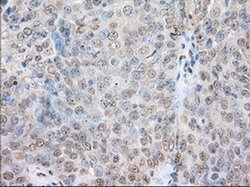 Invitrogen SNX9 Monoclonal Antibody (OTI1B5) 100 &mu;L; Unconjugated:Antibodies,