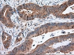 Invitrogen TACC3 Monoclonal Antibody (OTI7B11) 100 &mu;L; Unconjugated:Antibodies,