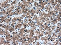 Invitrogen TACC3 Monoclonal Antibody (OTI7B11) 100 &mu;L; Unconjugated:Antibodies,