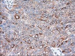 Invitrogen TACC3 Monoclonal Antibody (OTI7B11) 100 &mu;L; Unconjugated:Antibodies,
