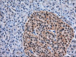 Invitrogen TACC3 Monoclonal Antibody (OTI7B11) 100 &mu;L; Unconjugated:Antibodies,
