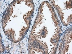 Invitrogen TACC3 Monoclonal Antibody (OTI7B11) 100 &mu;L; Unconjugated:Antibodies,
