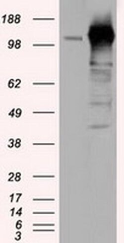 Invitrogen TACC3 Monoclonal Antibody (OTI7B11) 100 &mu;L; Unconjugated:Antibodies,