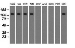 Invitrogen TACC3 Monoclonal Antibody (OTI7B11) 100 &mu;L; Unconjugated:Antibodies,