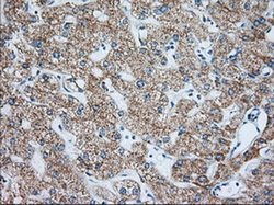 Invitrogen IGF2BP2 Monoclonal Antibody (OTI3F9) 100 &mu;L; Unconjugated:Antibodies,