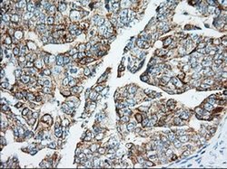 Invitrogen IGF2BP2 Monoclonal Antibody (OTI3F9) 100 &mu;L; Unconjugated:Antibodies,