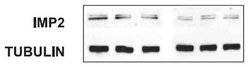 Invitrogen IGF2BP2 Monoclonal Antibody (OTI3F9) 100 &mu;L; Unconjugated:Antibodies,
