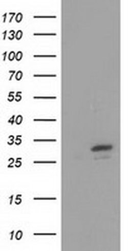 Invitrogen FHL1 Monoclonal Antibody (OTI2E11) 100 &mu;L; Unconjugated:Antibodies,