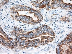 Invitrogen KHK Monoclonal Antibody (OTI1D8) 100 &mu;L; Unconjugated:Antibodies,