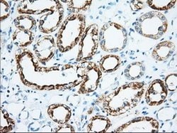 Invitrogen KHK Monoclonal Antibody (OTI1D8) 100 &mu;L; Unconjugated:Antibodies,