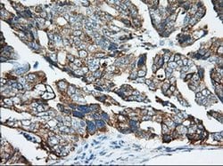 Invitrogen KHK Monoclonal Antibody (OTI1D8) 100 &mu;L; Unconjugated:Antibodies,