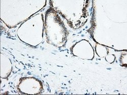 Invitrogen KHK Monoclonal Antibody (OTI1D8) 100 &mu;L; Unconjugated:Antibodies,