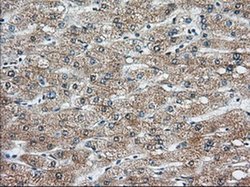 Invitrogen KHK Monoclonal Antibody (OTI4E9) 100 &mu;L; Unconjugated:Antibodies,