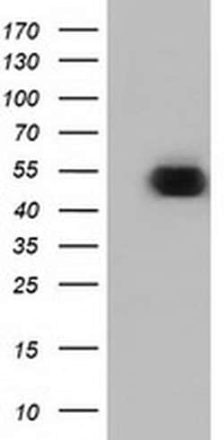 Invitrogen ODC1 Monoclonal Antibody (OTI1G6) 100 &mu;L | Buy Online | Invitrogen&trade; | Fisher Scientific