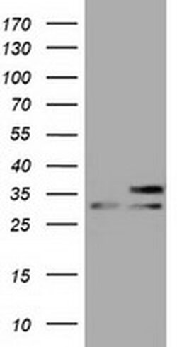 Invitrogen FHL1 Monoclonal Antibody (OTI3G7) 100 &mu;L; Unconjugated:Antibodies,
