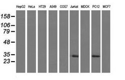 Invitrogen FHL1 Monoclonal Antibody (OTI3G7) 100 &mu;L; Unconjugated:Antibodies,