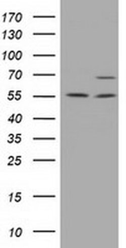 Invitrogen MPP3 Monoclonal Antibody (OTI8B11) 100 &mu;L; Unconjugated:Antibodies,