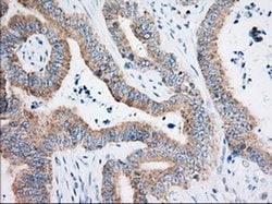Invitrogen HIBCH Monoclonal Antibody (OTI3H5) 100 μL; Unconjugated:Antibodies,