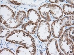 Invitrogen HIBCH Monoclonal Antibody (OTI3H5) 100 μL; Unconjugated:Antibodies,