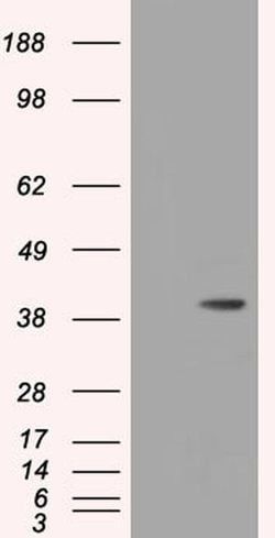 Invitrogen HIBCH Monoclonal Antibody (OTI3H5) 100 μL; Unconjugated:Antibodies,
