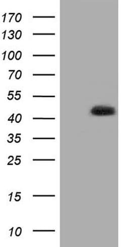 Invitrogen HIBCH Monoclonal Antibody (OTI1C7) 100 &mu;L; Unconjugated:Antibodies,