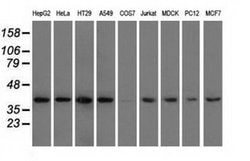 Invitrogen HIBCH Monoclonal Antibody (OTI1C7) 100 &mu;L; Unconjugated:Antibodies,