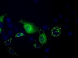 Invitrogen PANK2 Monoclonal Antibody (OTI3H9) 100 μL; Unconjugated:Antibodies,