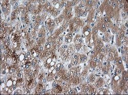 Invitrogen PANK2 Monoclonal Antibody (OTI3H9) 100 μL; Unconjugated:Antibodies,