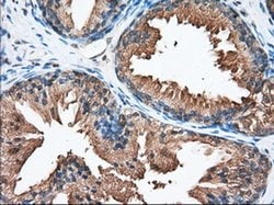 Invitrogen PANK2 Monoclonal Antibody (OTI3H9) 100 μL; Unconjugated:Antibodies,
