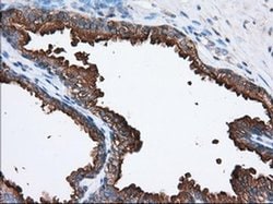 Invitrogen PANK2 Monoclonal Antibody (OTI3H9) 100 μL; Unconjugated:Antibodies,