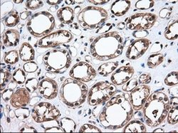 Invitrogen Thromboxane synthase Monoclonal Antibody (OTI2C1) 100 &mu;L;