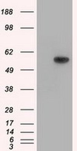 Invitrogen Thromboxane synthase Monoclonal Antibody (OTI2C1) 100 &mu;L;