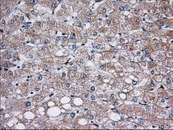 Invitrogen Thromboxane synthase Monoclonal Antibody (OTI1H1) 100 &mu;L;