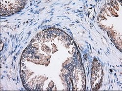 Invitrogen Thromboxane synthase Monoclonal Antibody (OTI1H1) 100 &mu;L;