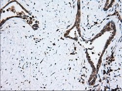 Invitrogen Thromboxane synthase Monoclonal Antibody (OTI1H1) 100 &mu;L;