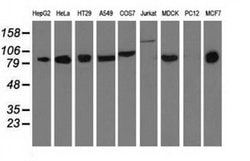Invitrogen DGKB Monoclonal Antibody (OTI1F9) 100 &mu;L; Unconjugated:Antibodies,