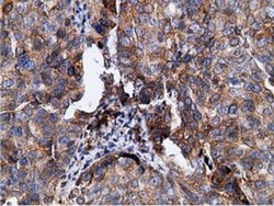 Invitrogen KHK Monoclonal Antibody (OTI3D1) 100 &mu;L; Unconjugated:Antibodies,
