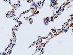 Invitrogen KHK Monoclonal Antibody (OTI3D1) 100 &mu;L; Unconjugated:Antibodies,
