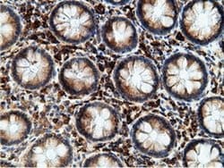Invitrogen KHK Monoclonal Antibody (OTI3D1) 100 &mu;L; Unconjugated:Antibodies,