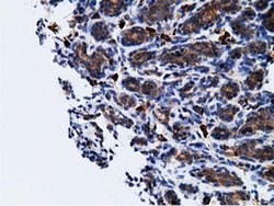 Invitrogen KHK Monoclonal Antibody (OTI3D1) 100 &mu;L; Unconjugated:Antibodies,