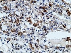 Invitrogen KHK Monoclonal Antibody (OTI3D1) 100 &mu;L; Unconjugated:Antibodies,