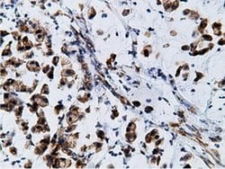 Invitrogen KHK Monoclonal Antibody (OTI3D1) 100 &mu;L; Unconjugated:Antibodies,