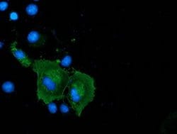 Invitrogen Coronin 1A Monoclonal Antibody (OTI1A5) 100 &mu;L; Unconjugated:Antibodies,
